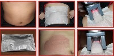 Multi-polar RF Cavitation Cryolipolysis Slimming Machine Strong Sonic Instrument Negative